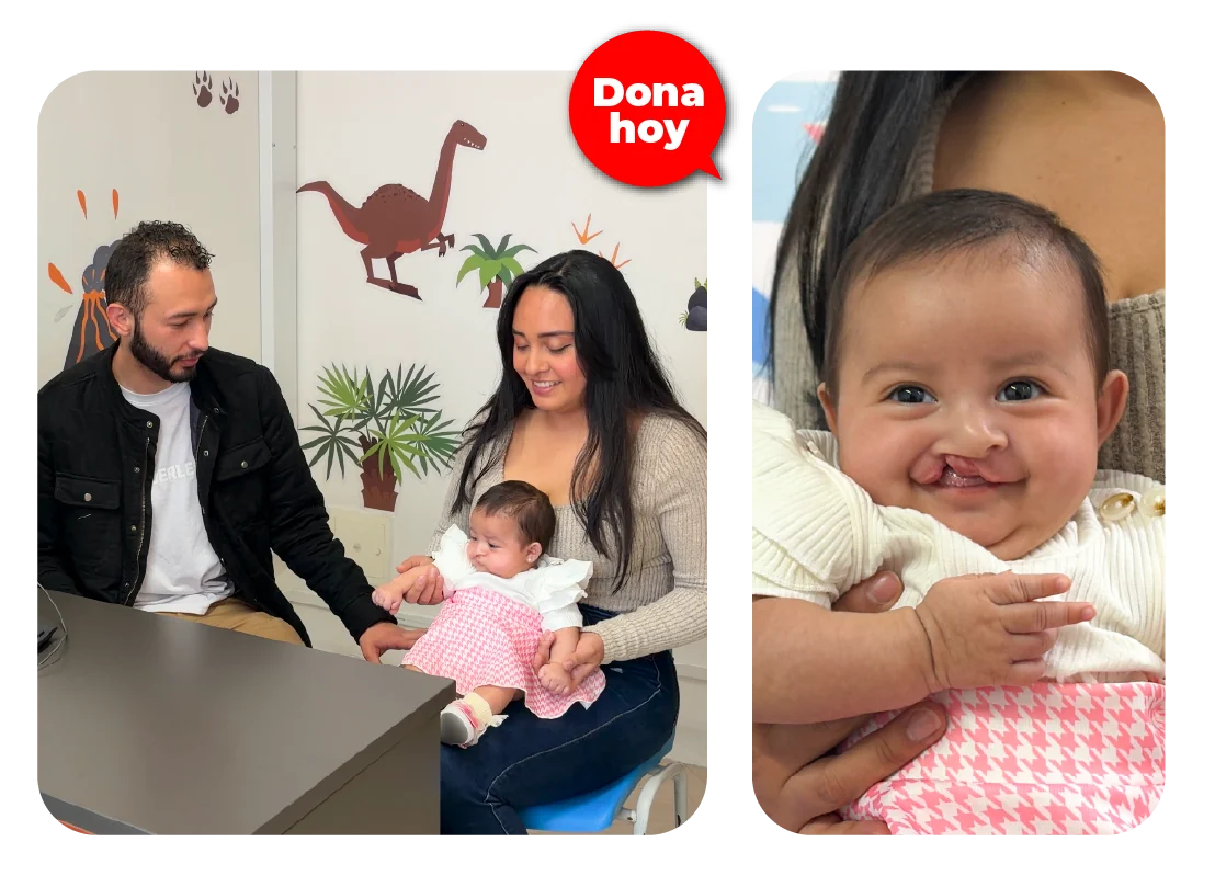Lucy Caroline, una bebé de 3 meses con labio fisurado, en brazos de sus papás durante una consulta en Operación Sonrisa Colombia.
