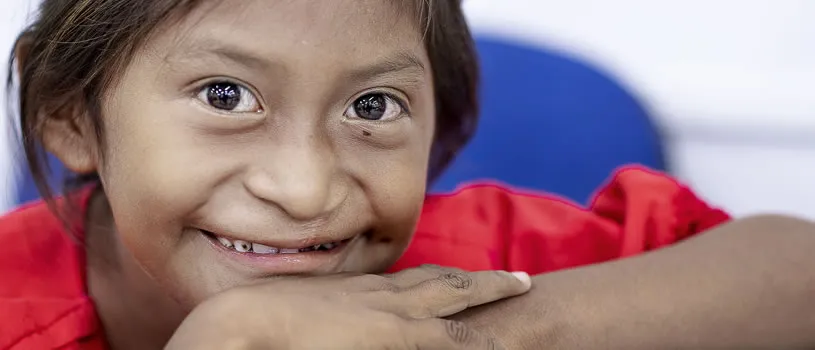 Perseverancia y resiliencia: el viaje de sanación de Lexxi a través de Operación Sonrisa Colombia - Fundación Operación Sonrisa Colombia