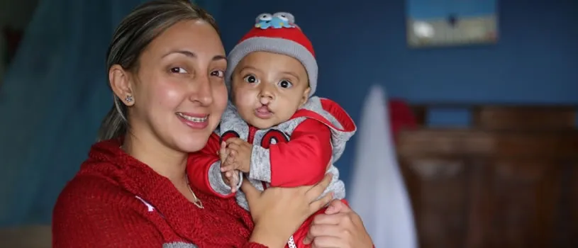 Transformando vidas: La historia de Douglas e Irma - Fundación Operación Sonrisa Colombia