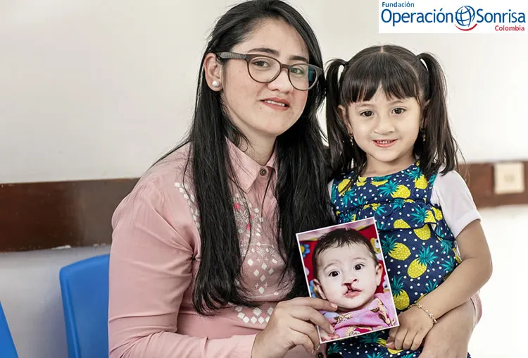 Nury y Luciana años después luego la primera ciurgía de Luciana.