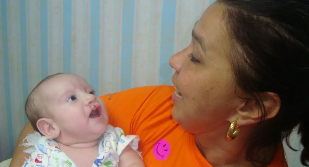 Adriana Serrano: más de 20 años transformando vidas como voluntaria de Operación Sonrisa